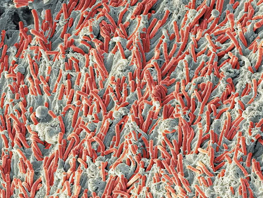 Fusobacterium Photograph - Dental Plaque, Sem #7 by Steve Gschmeissner