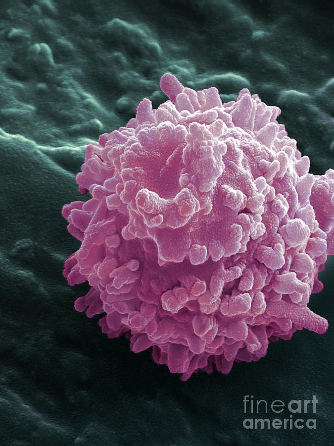 Human Lymphocyte Cell, Sem #7 Photograph by Ted Kinsman