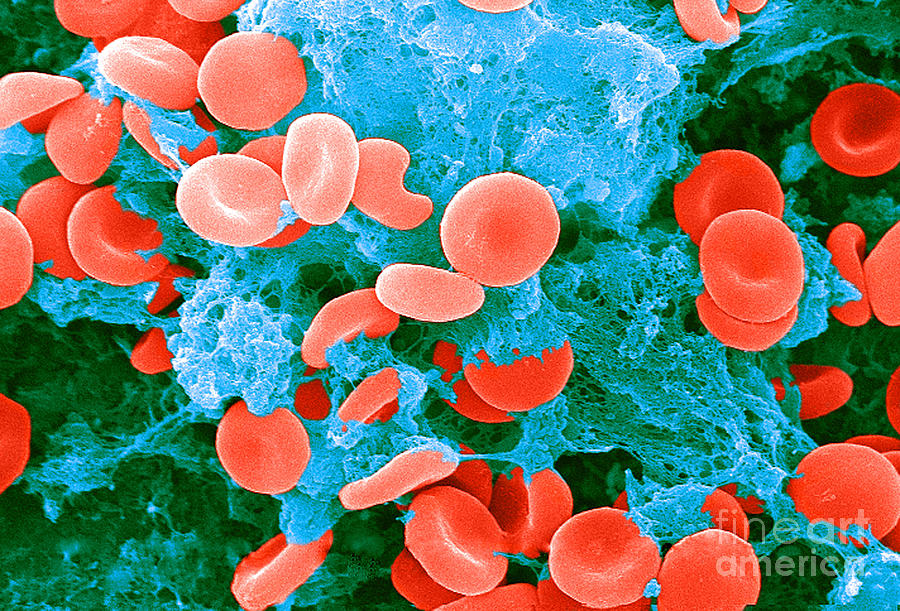 Red Blood Cells, Sem #7 Photograph by Science Source