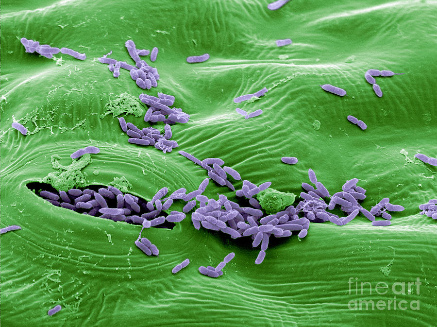 Sem Of E. Coli Bacteria On Lettuce #7 Photograph by Scimat