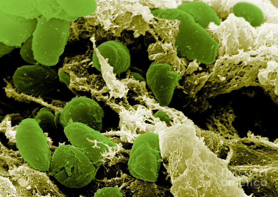 Yersinia Pestis Bacteria, Sem Photograph by Science Source