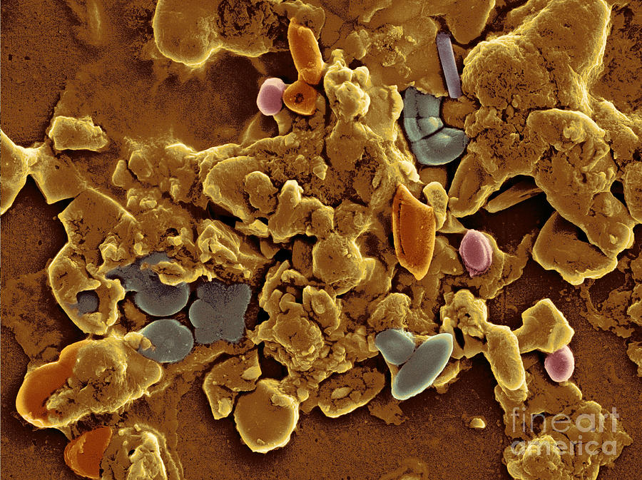 Aerosolized Droplet Of Toilet Water Sem #8 Photograph by Scimat