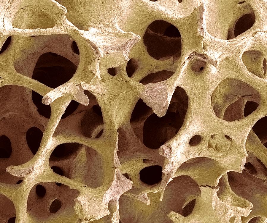 Spongy Bone Photograph - Bone Tissue, Sem #8 by Steve Gschmeissner