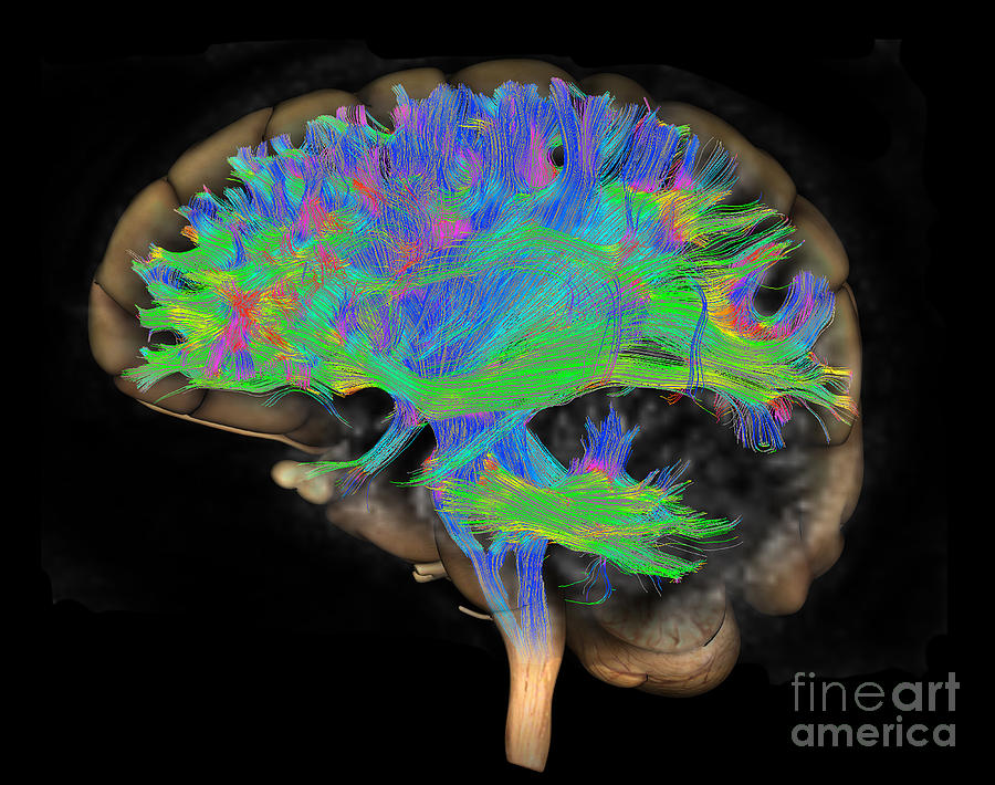 Brain, Fiber Tractography Image #8 Photograph by Scott Camazine