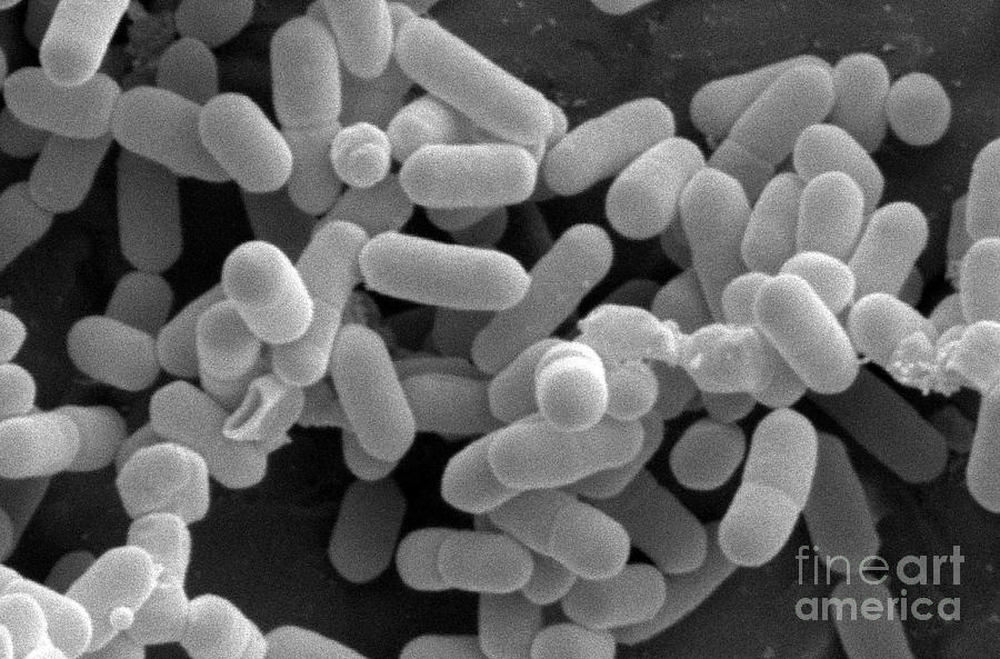 Listeria Monocytogenes Bacteria #8 Photograph by Scimat - Pixels