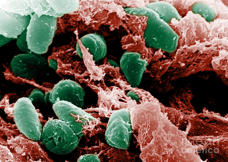 Microbiology Photograph - Yersinia Pestis Bacteria, Sem #8 by Science Source