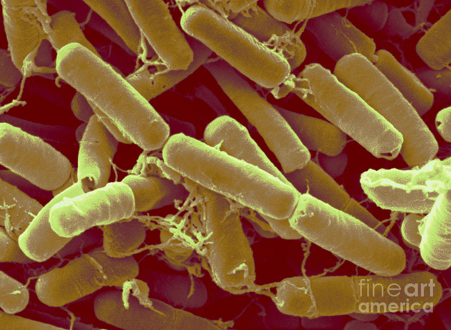 Bacillus Thuringiensis Bacteria #9 Photograph by Scimat
