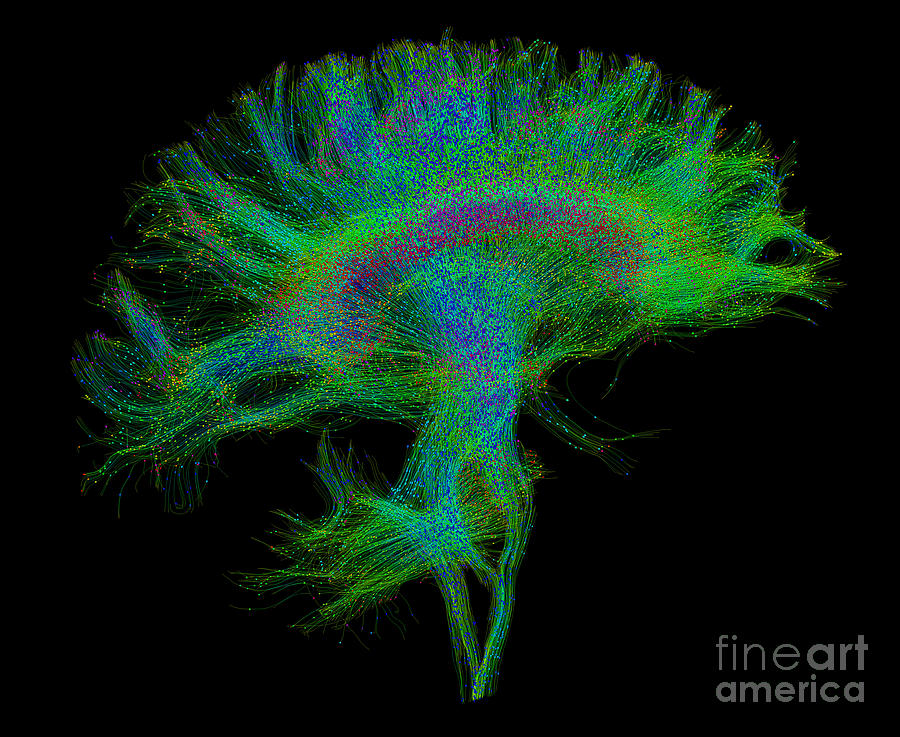 Brain, Fiber Tractography Image #9 Photograph by Scott Camazine