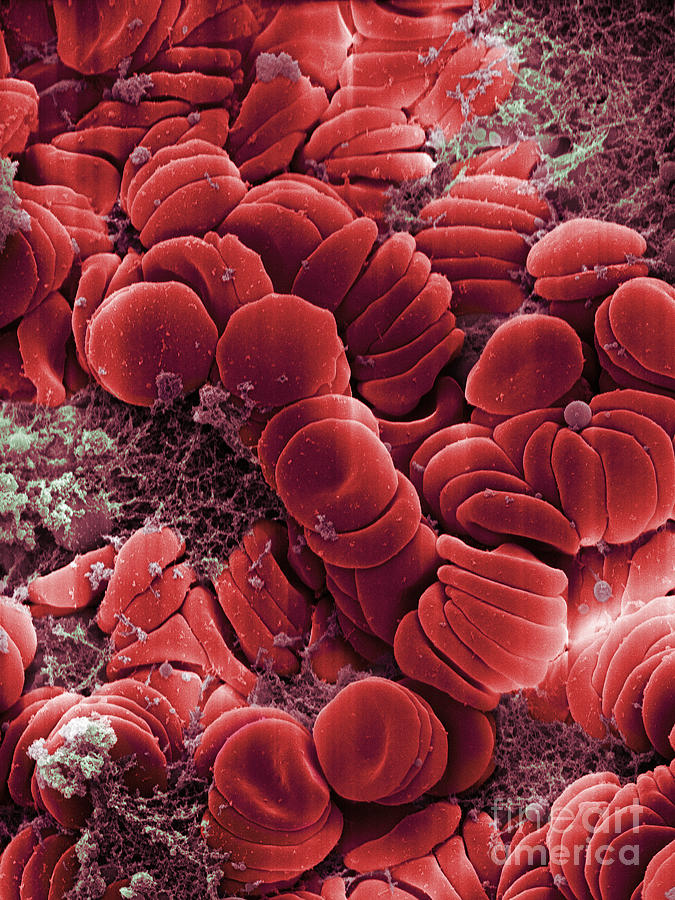 Human Red Blood Cells, Sem #9 Photograph by Ted Kinsman