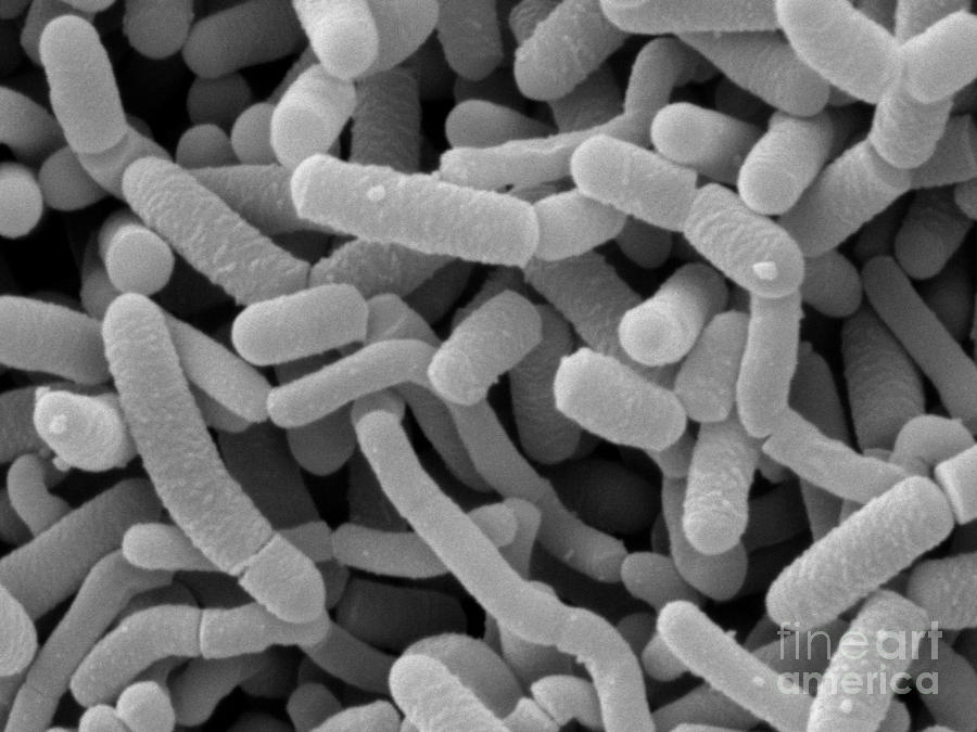 Lactobacillus Acidophilus And L. Casei Photograph by Scimat - Pixels