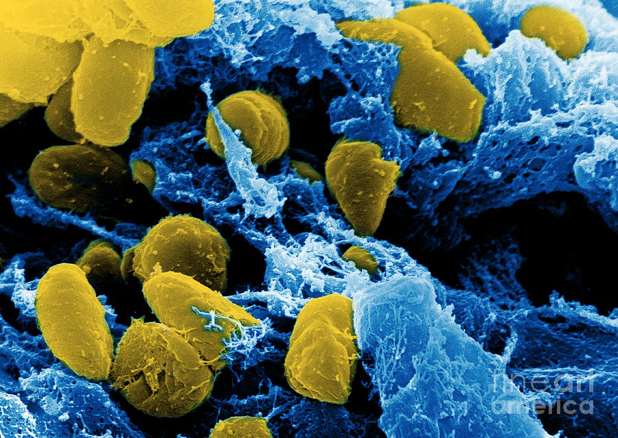 Yersinia Pestis Bacteria, Sem #9 Photograph by Science Source