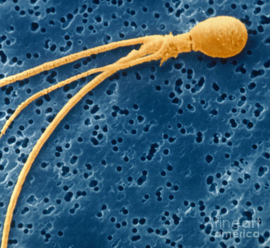 Abnormal Sperm Photograph by Scimat