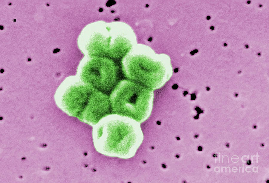 Acinetobacter Baumannii, Sem Photograph by Science Source