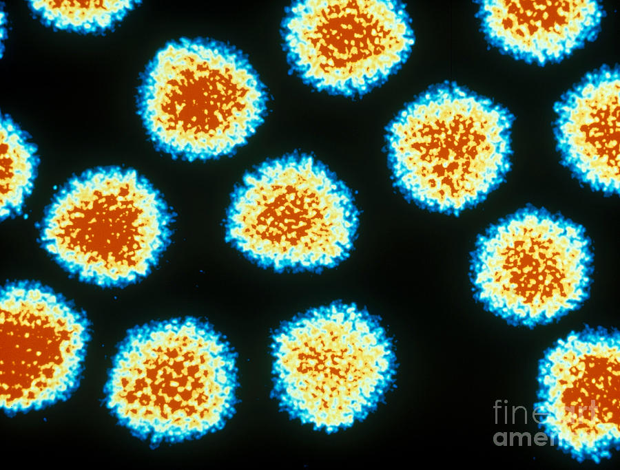 Medical Photograph - Adenovirus Tem by Omikron