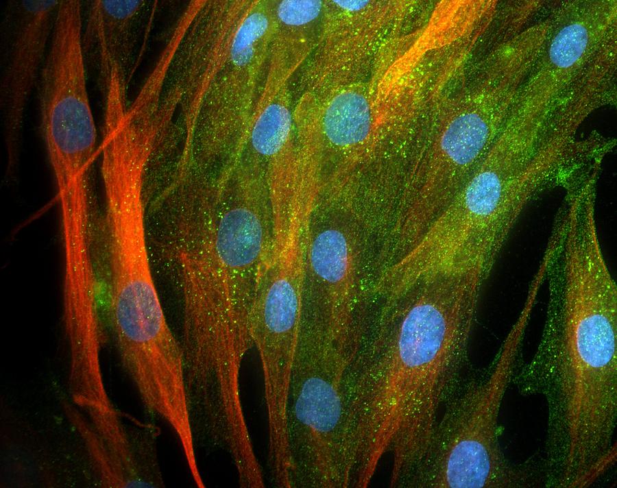 Cytology Photograph - Adipose Stem Cells, Light Micrograph by Riccardo Cassiani-ingoni