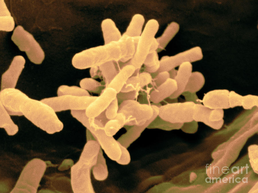 Agrobacterium Tumefaciens Photograph by Scimat