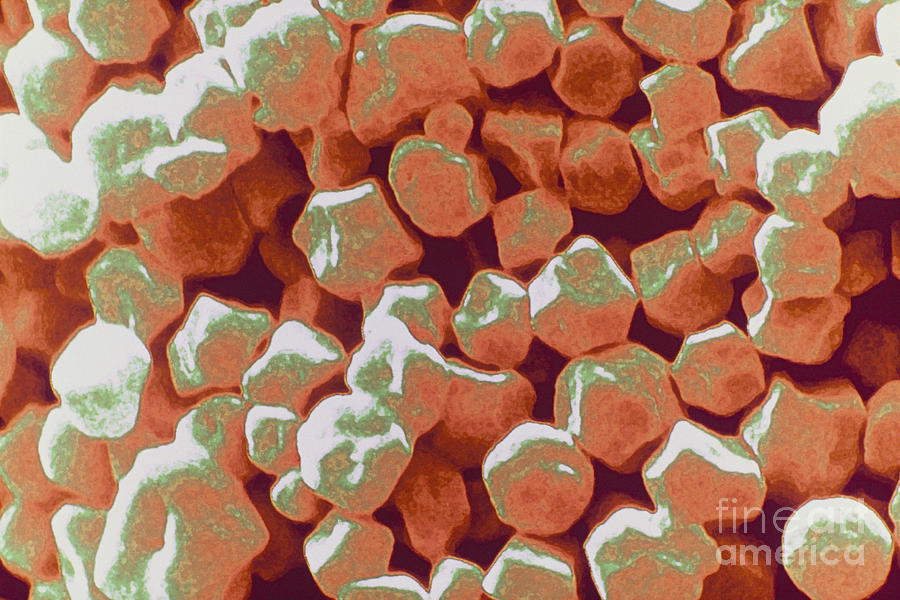 Amaranth Starch Granules Sem Photograph by Scimat