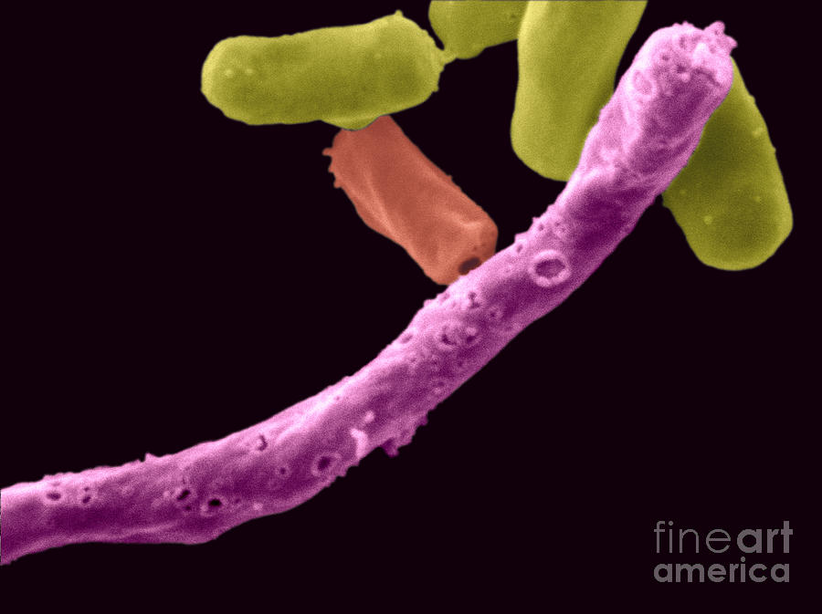 Anaerobic Pathogen Photograph by Scimat