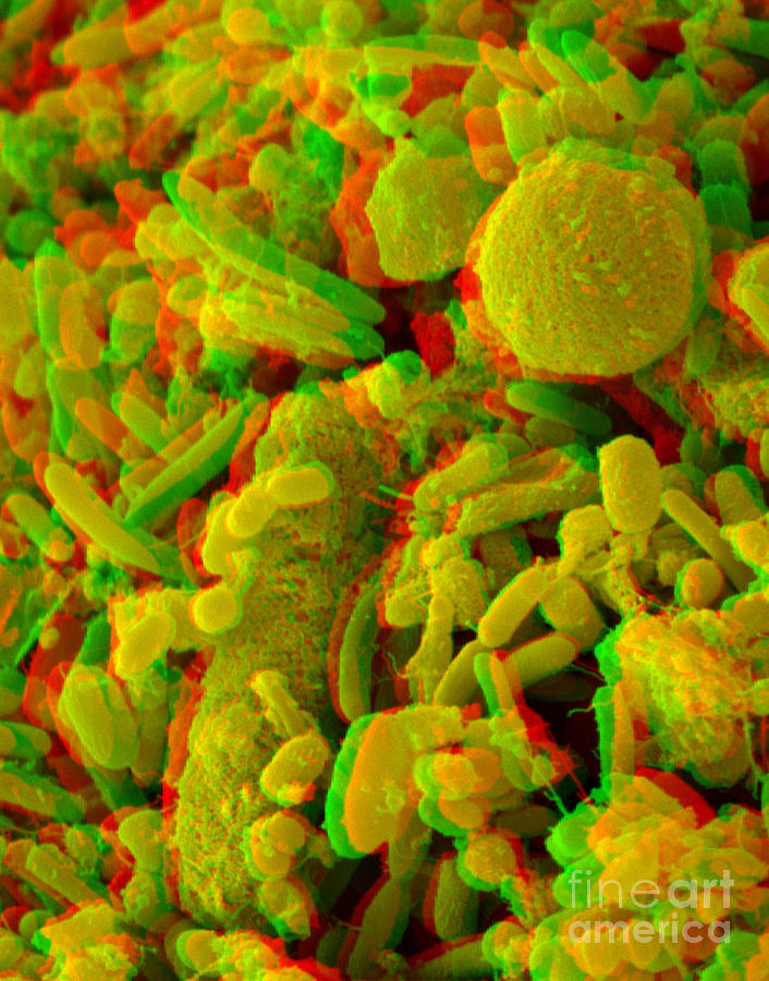 Anaglyph Of Human Feces Photograph by Scimat