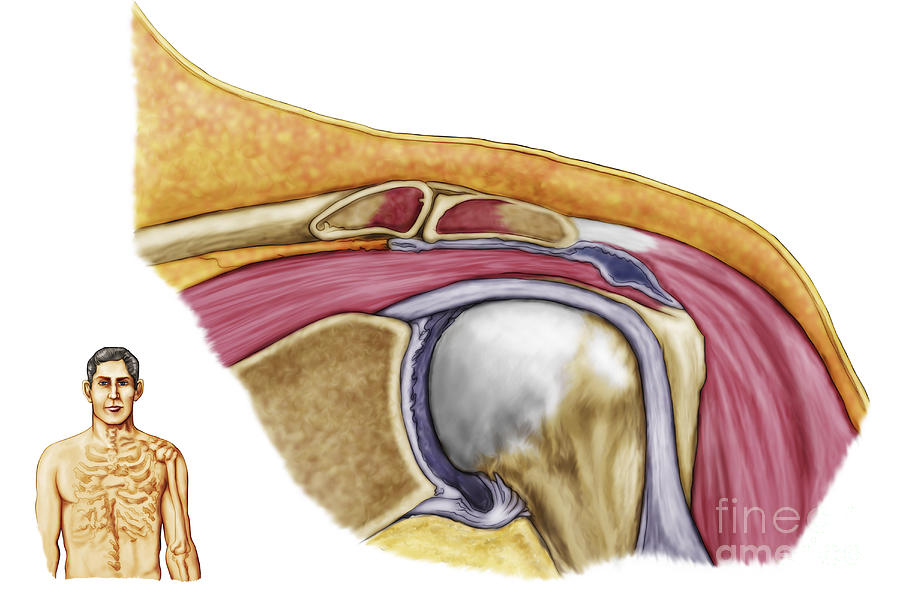 Healthcare Digital Art - Anatomy Of Left Shoulder, Coronal View by Stocktrek Images