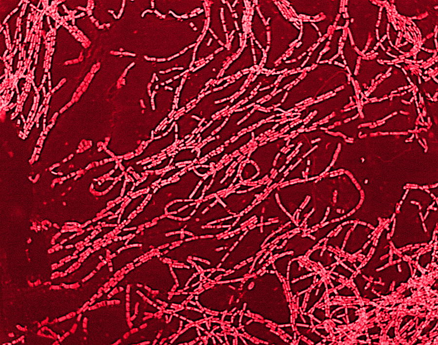Anthrax Bacteria Photograph By Biomedical Imaging Unit Southampton General Hospital 8918