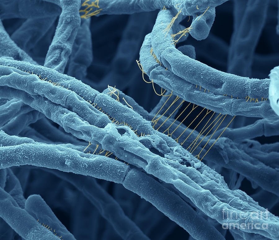 Anthrax bacteria SEM Photograph by Eye Of Science and Photo Researchers