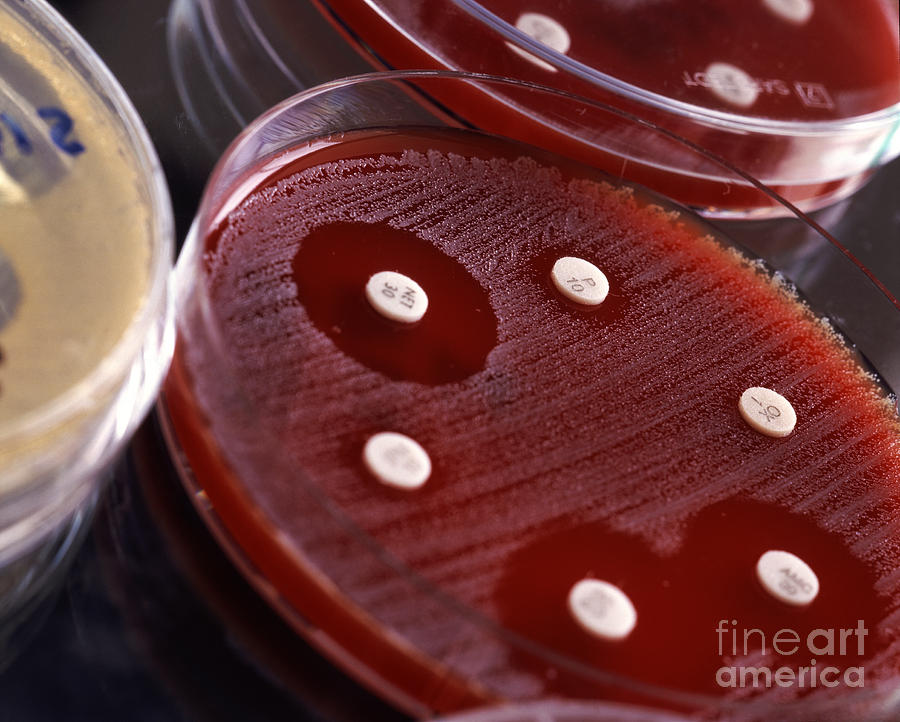 Antibiotic Testing Photograph by Dr. Martin Baumgrtner