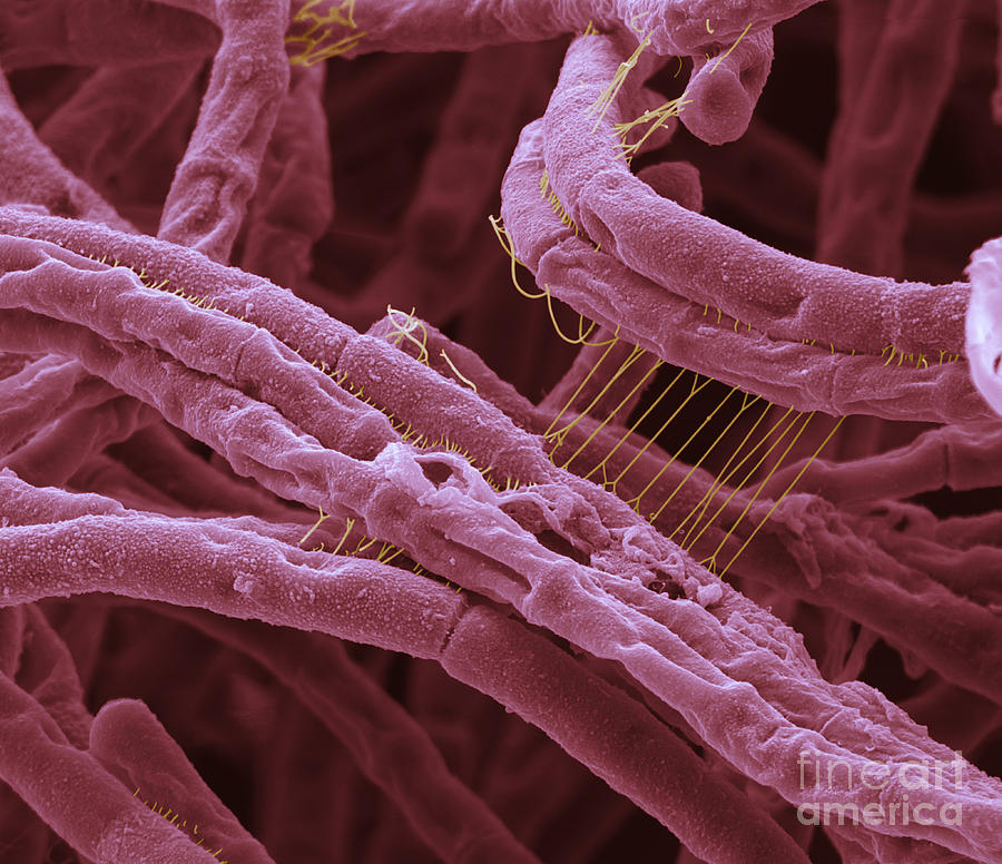 Anthracis Photograph - Anthrax bacteria, SEM #1 by Eye of Science