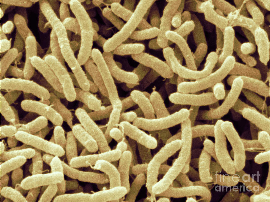 Arcobacter Septicus Bacteria, Sem Photograph by Scimat