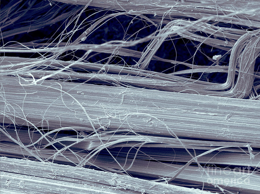 Asbestos Fibers Photograph by Scimat