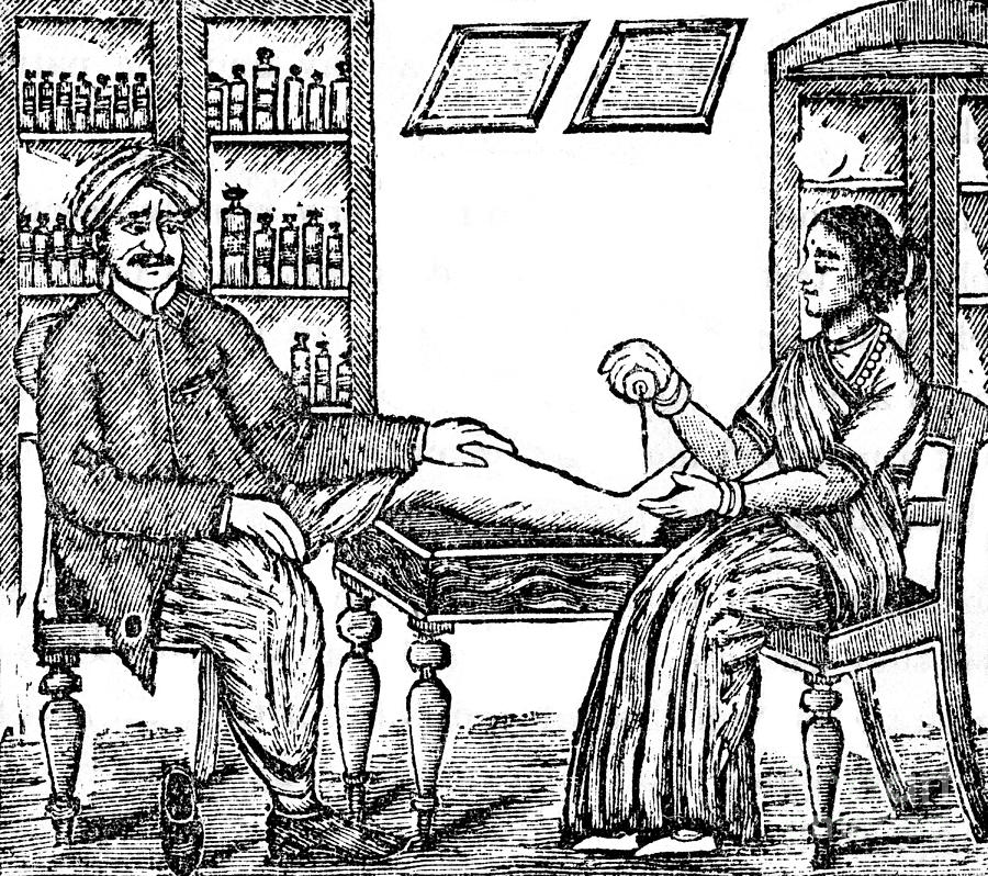 Ayurvedic Medicine, Gout Treatment Photograph by Wellcome Images