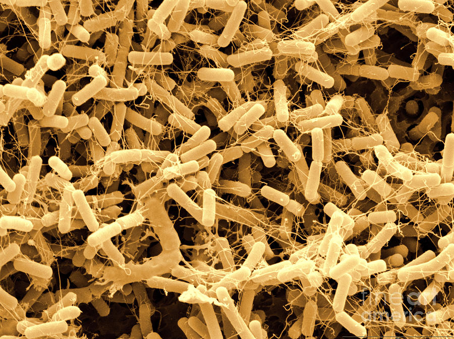 Bacillus Amyloliquefaciens Sem Photograph by Scimat