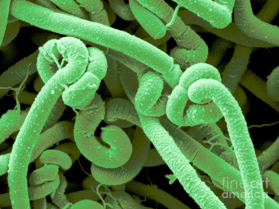 Bacillus Cereus Photograph by Scimat