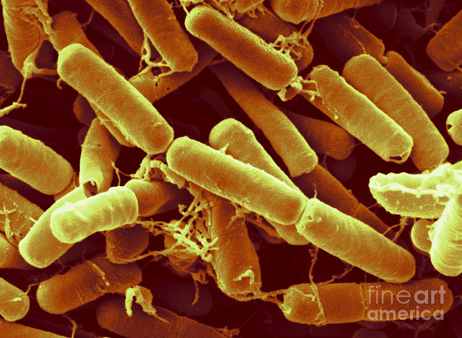 Bacillus Thuringiensis Baccteria Photograph by Scimat