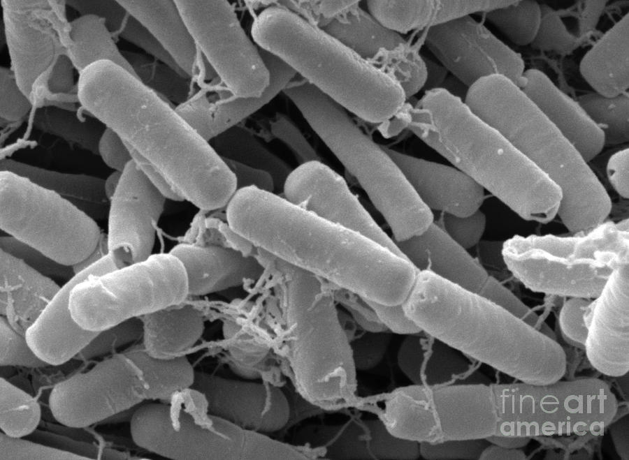 Bacillus Thuringiensis Bacteria Photograph by Scimat