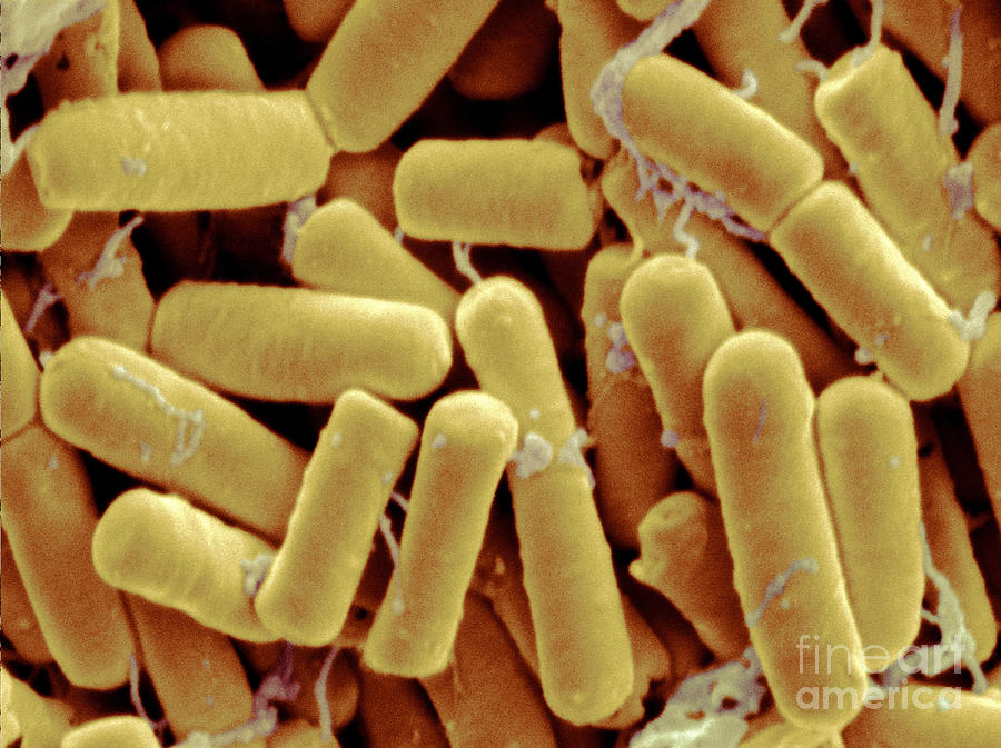 Bacillus Thuringiensis Photograph by Scimat