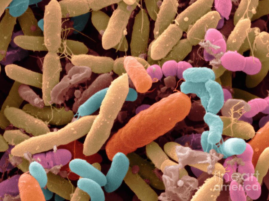 Bacteria Carried By Fruit Flies Photograph by Scimat