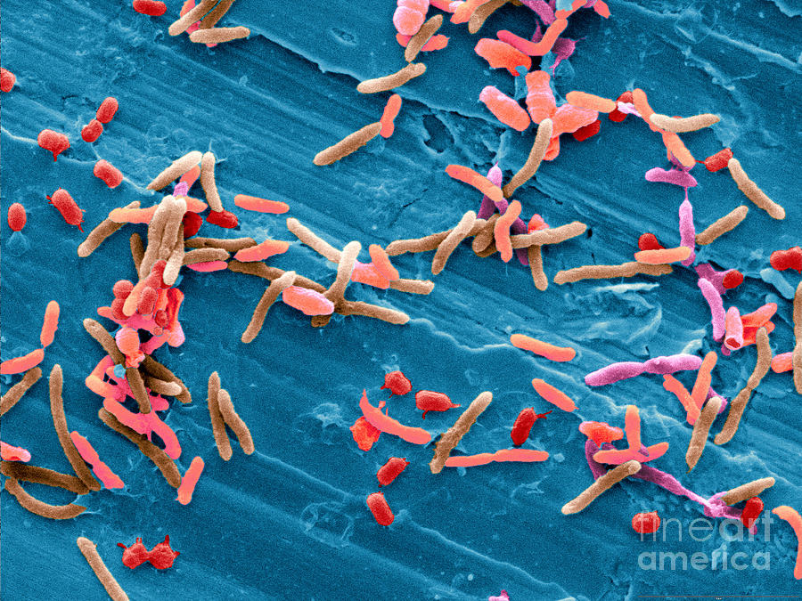 Bacteria From Raw Chicken Meat, Sem Photograph by Scimat - Pixels