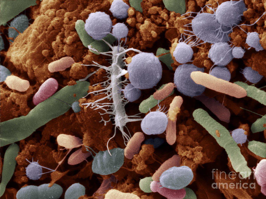 Bacteria In Cat Feces Photograph by Scimat