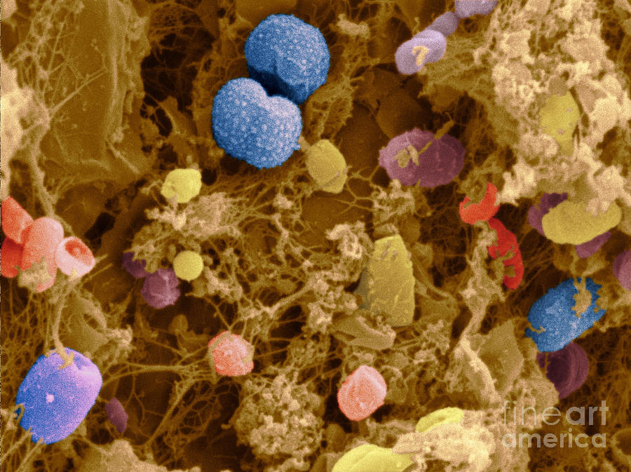 Bacteria In Cow Feces, Sem Photograph by Scimat
