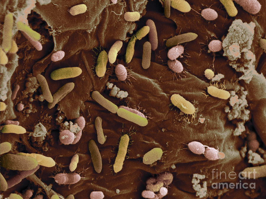 Bacteria In Dog Feces Photograph by Scimat