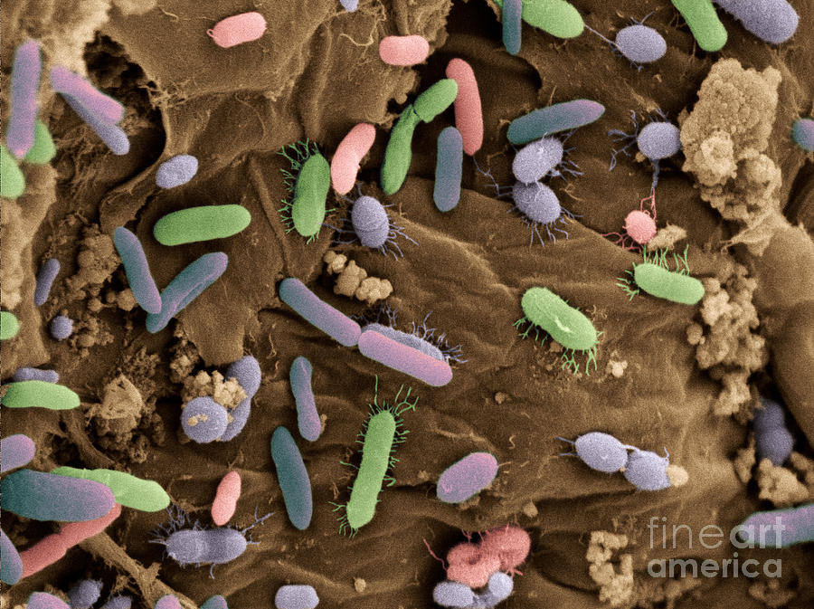 Bacteria Photograph - Bacteria In Dog Feces, Sem by Scimat