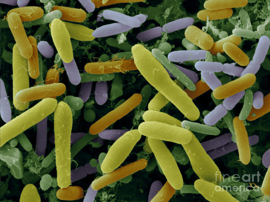 Bacteria In Goose Droppings Sem Photograph by Scimat