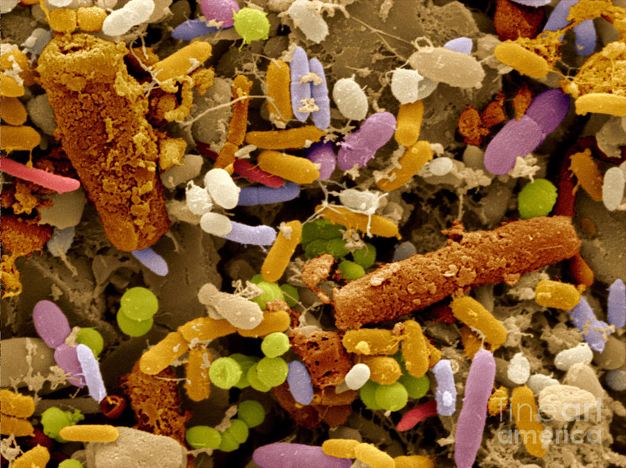 Bacteria In Human Feces Photograph by Scimat