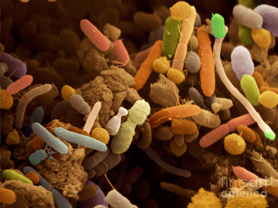 Bacteria In Human Feces, Sem Photograph by Scimat