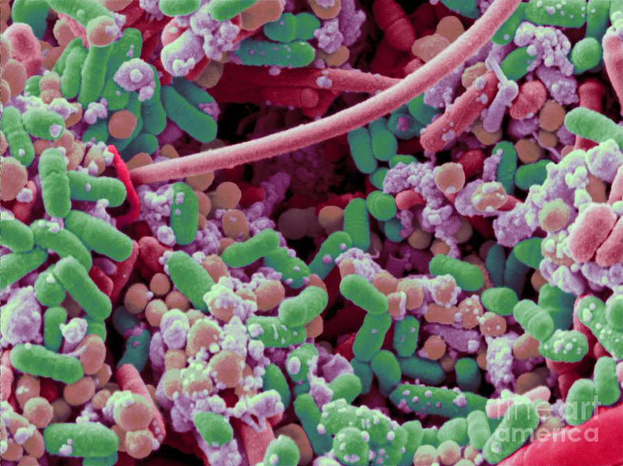 Bacteria In Human Tonsil Pus, Sem Photograph by Scimat