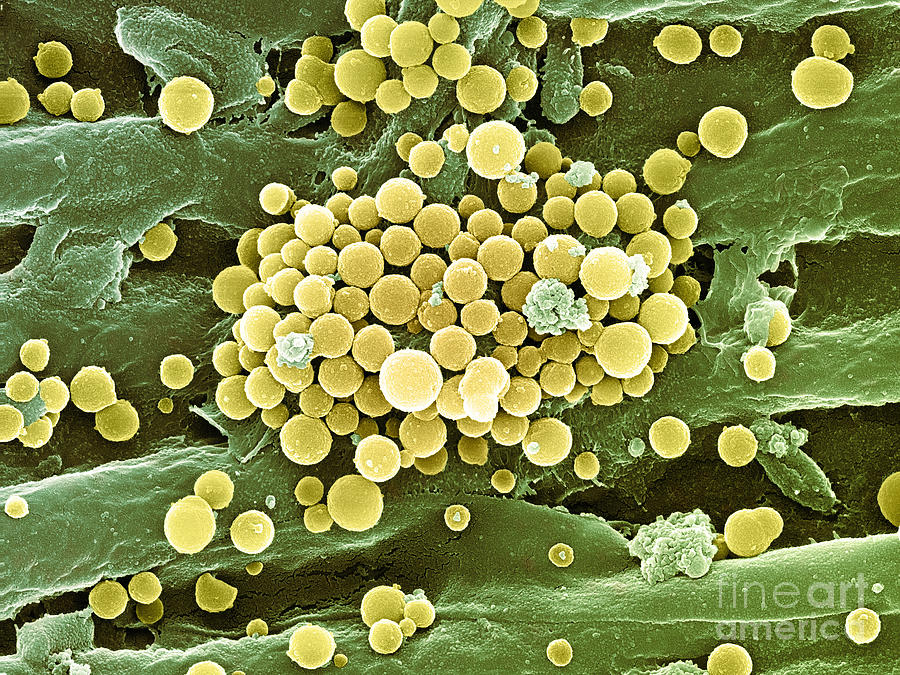 Bacteria On Hops Leaf, Sem Photograph by Ted Kinsman