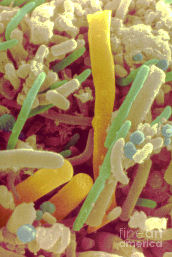 Bacteria On Human Tongue Photograph by Scimat