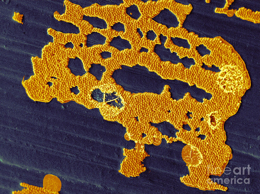 Bacterial Biofilm Photograph by Scimat