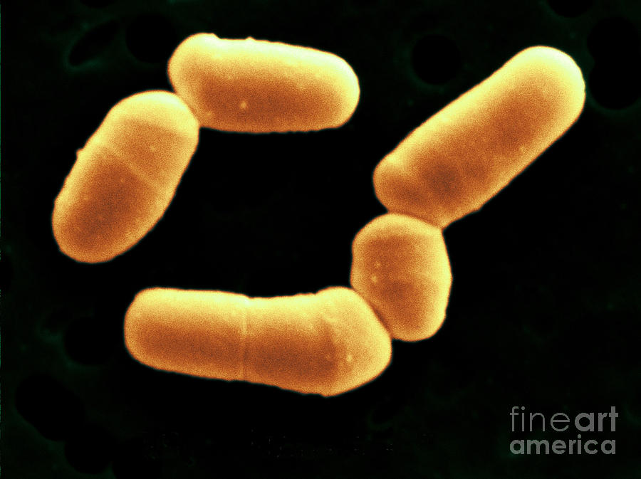 Бифидобактерии 5. Бифидобактерии бифидум микроорганизмы. Bifidum бактерии.